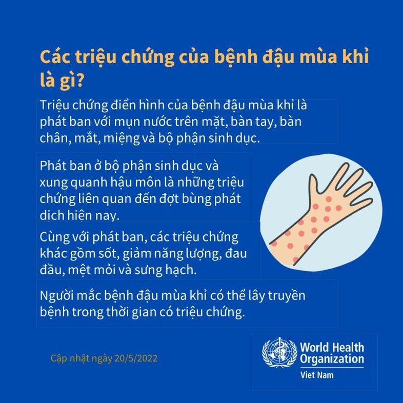 Bài truyền thông "Chủ động phòng, chống dịch bệnh đậu mùa khỉ tại Việt Nam"